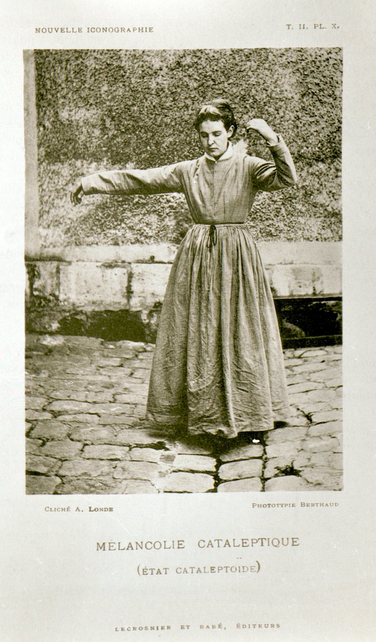 Mélancolie cataleptique, de 