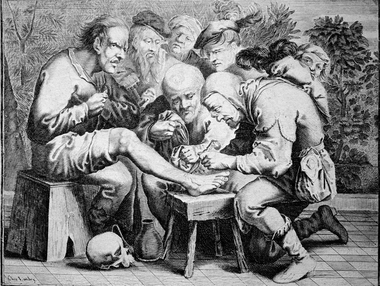 Chirurgie de la cheville (gravure) - Anonymous Anonymous