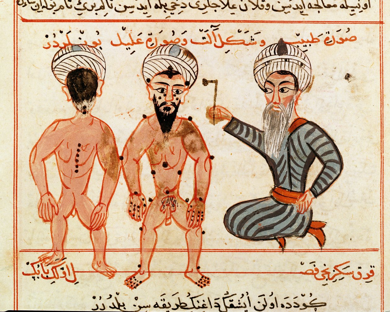 Ms Sup Turc 693 fol.46v Cautérisation des lésions de la lèpre, 1466 - Charaf ed Din