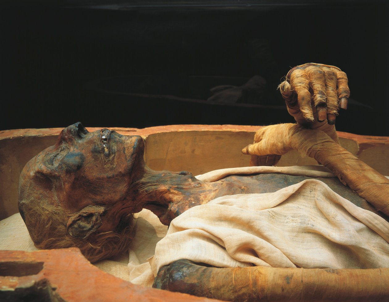 Momie de Ramsès II, détail - Egyptian 19th Dynasty