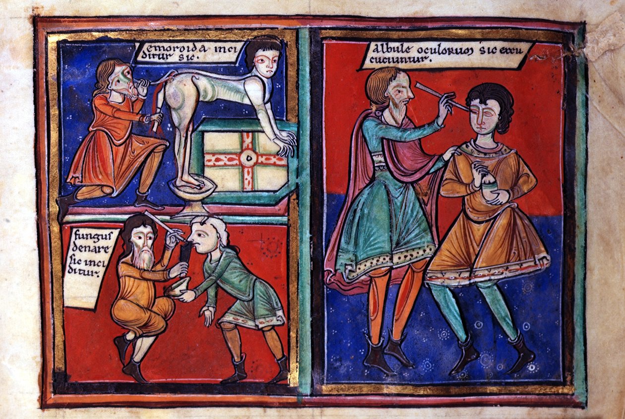 Sloane Ms 1975 fol.93 Opérations médicales - English School