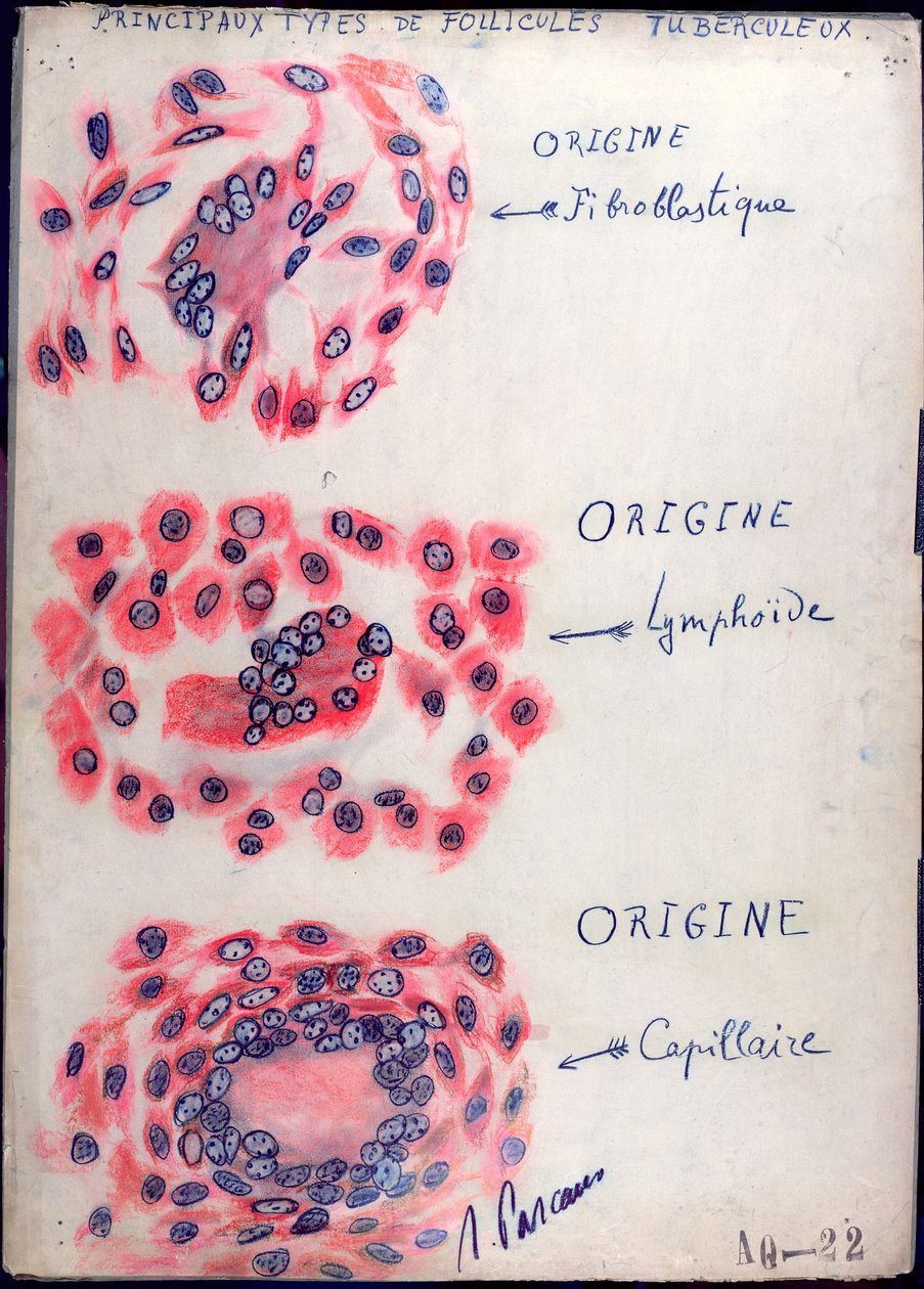 Follicules tuberculeux principaux - French School