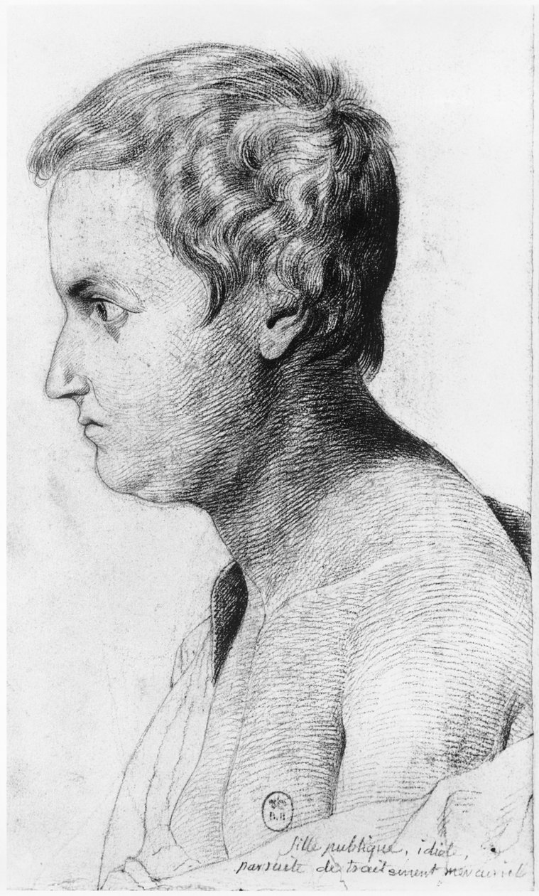 Prostituée idiote souffrant de syphilis, illustration d