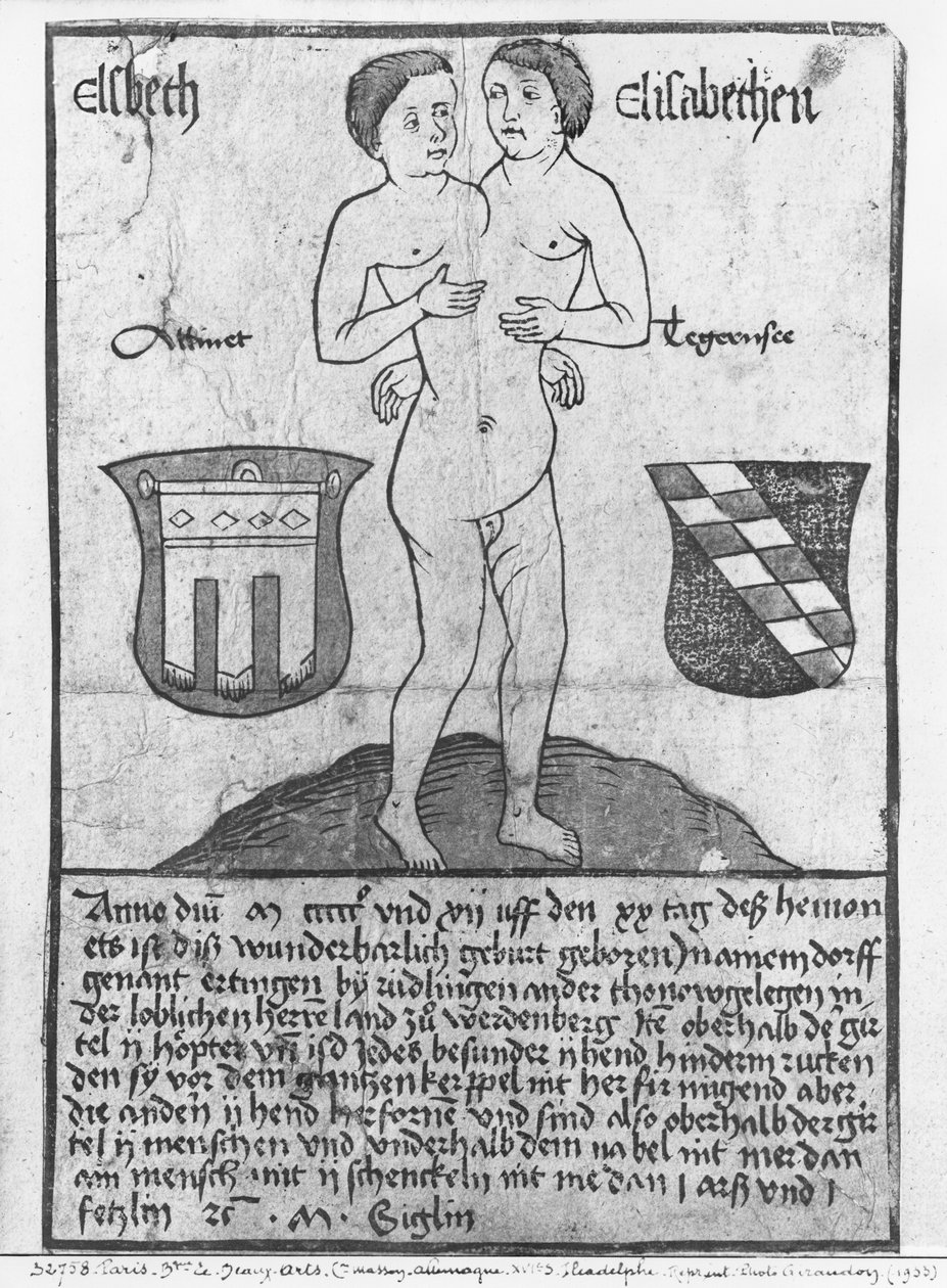 Filles siamoises, Elsbeth et Elisabethen (gravure sur bois et aquarelle) - German School