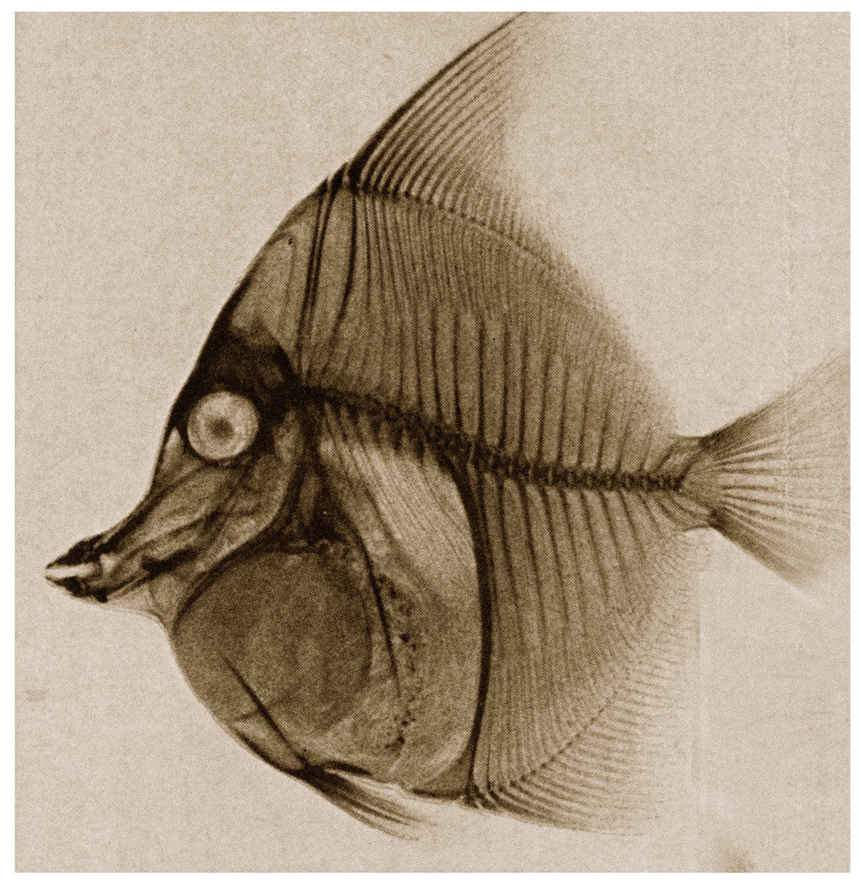 Radiographie d