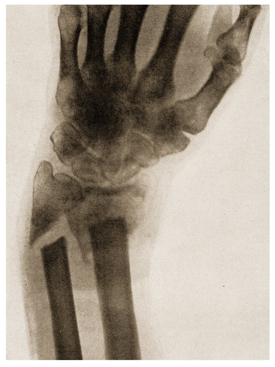 Radiographie d