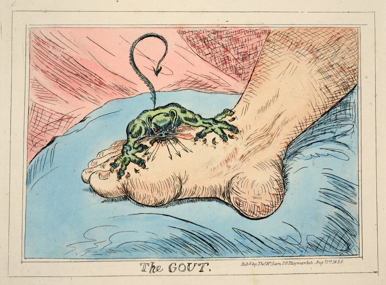 La Goutte, pub. 1835 (gravure colorée à la main) - James Gillray