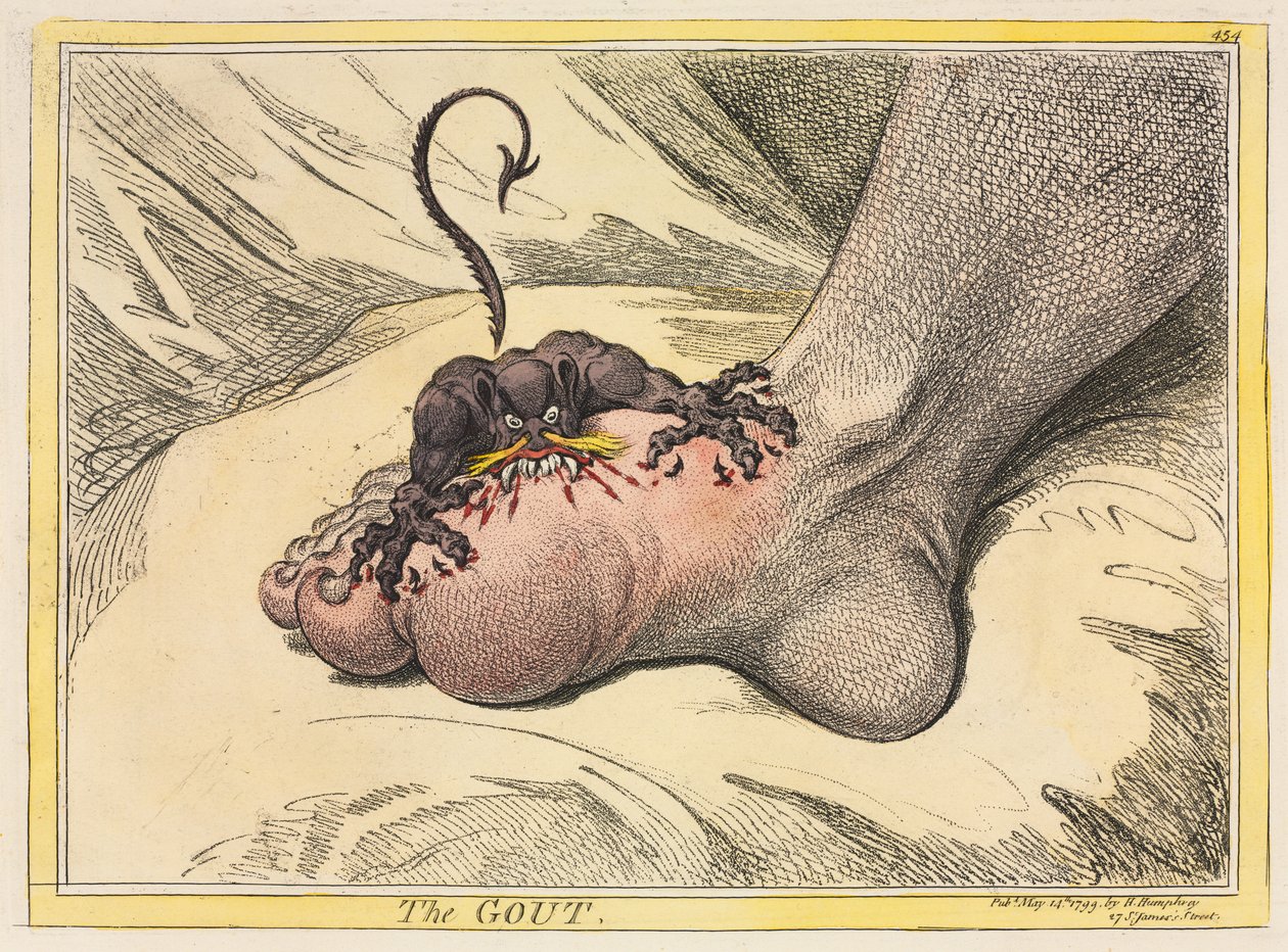 La Goutte, 1799 - James Gillray