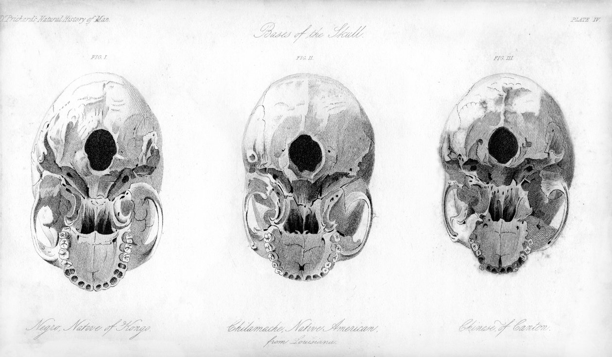 Base du crâne, 1848 - Unbekannt