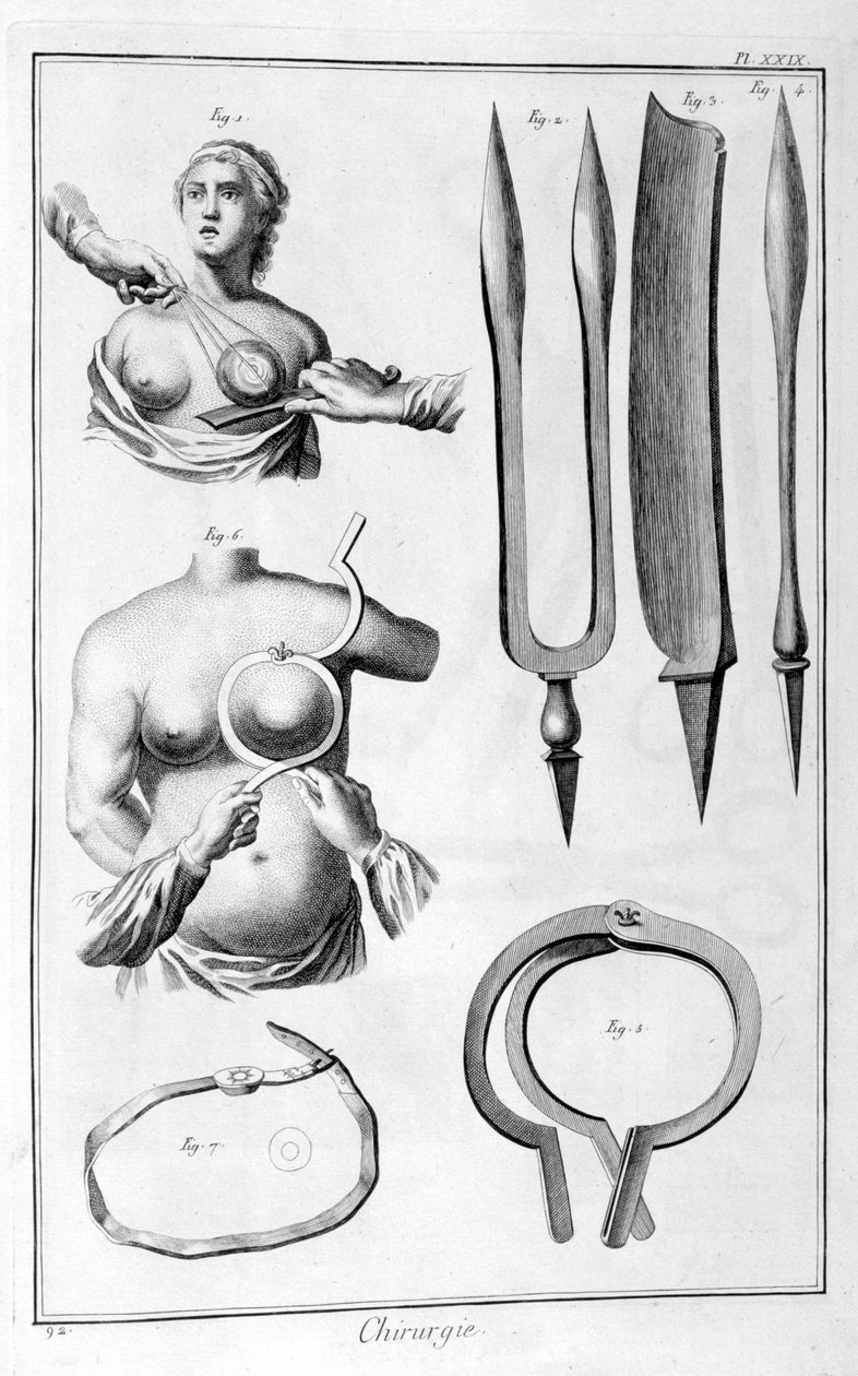 Chirurgie mammaire, 1751-1777 - Unbekannt