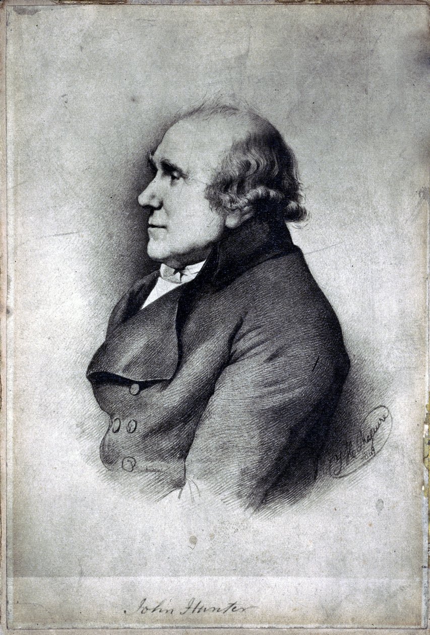 John Hunter, chirurgien et anatomiste britannique, vers 1770 - Unbekannt