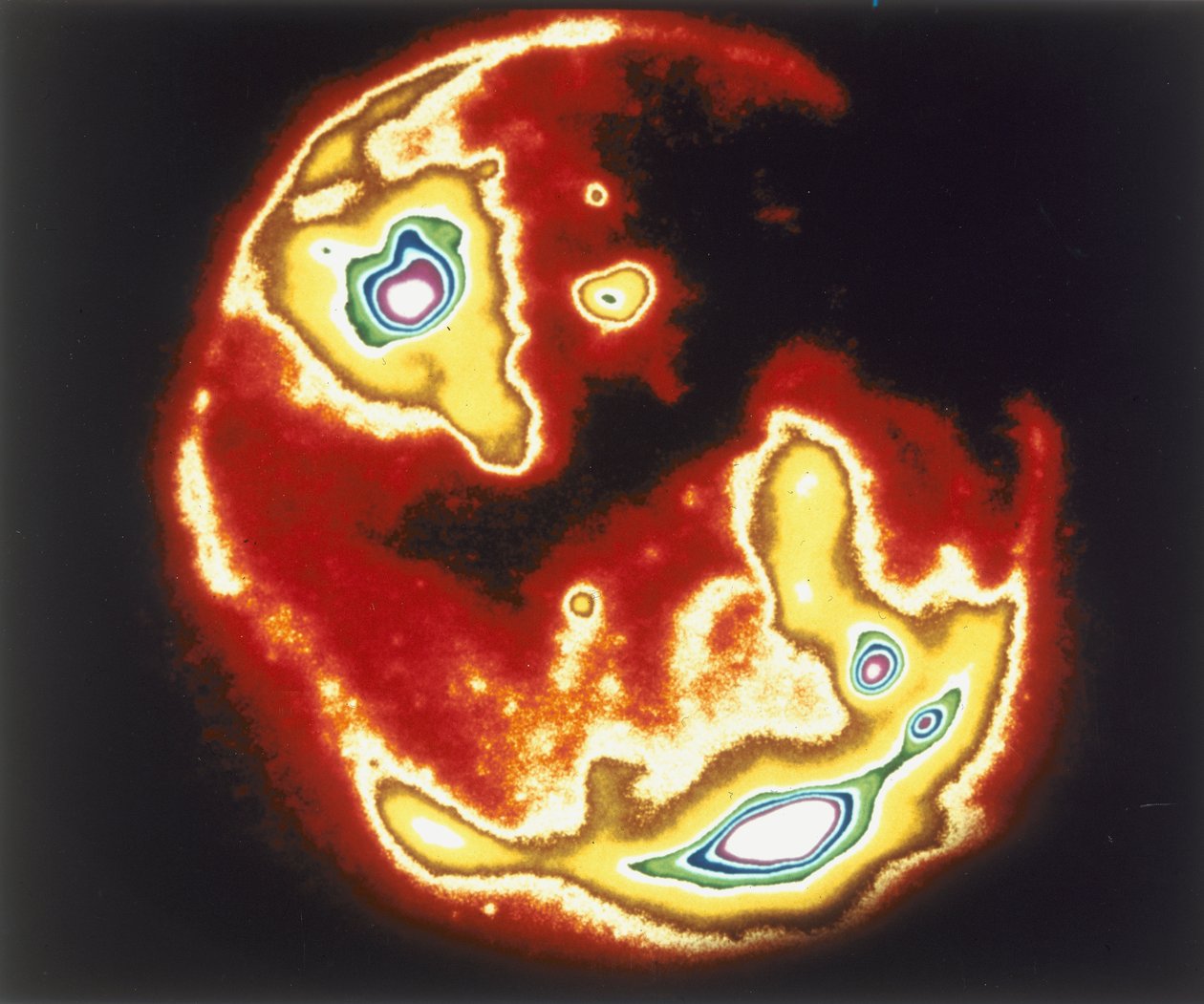 Image radiographique du soleil, Skylab, années 1970 - Unbekannt