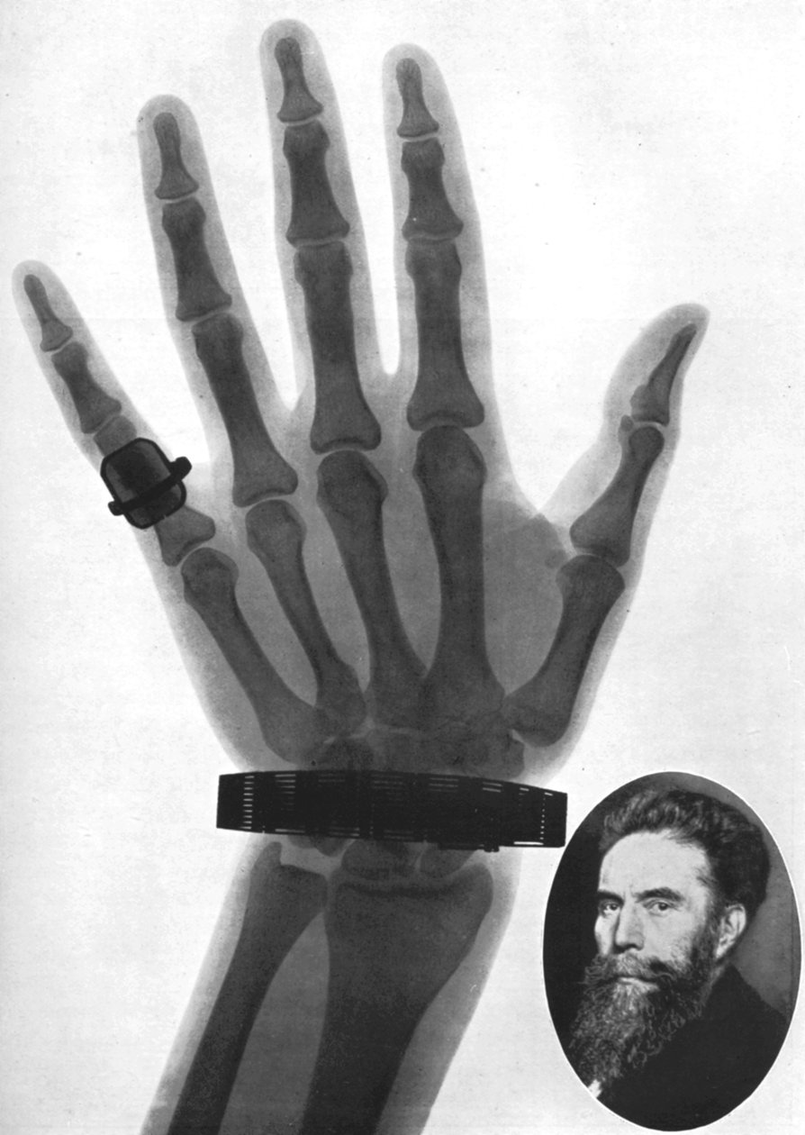 Radiographie d