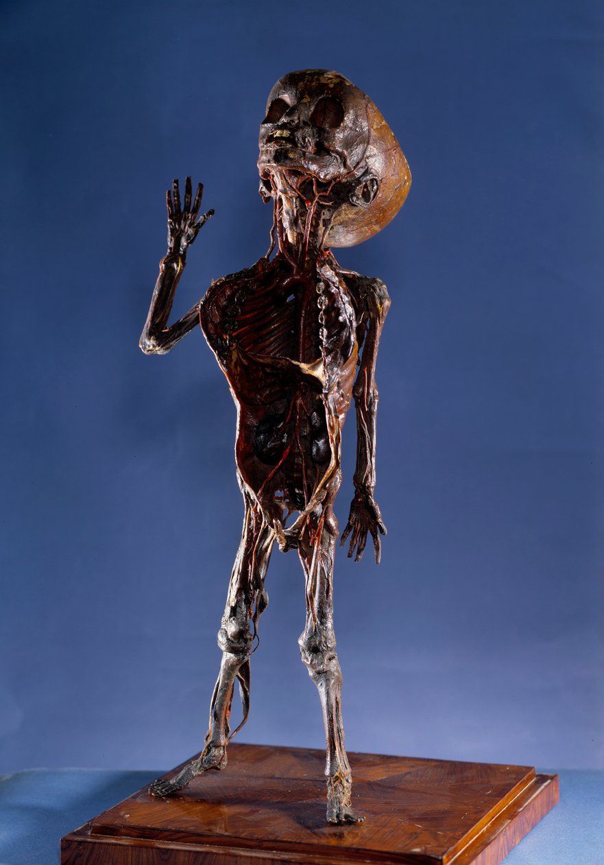 Médecine : figurine en pelure. 18ème siècle. Collection privée - Unknown artist