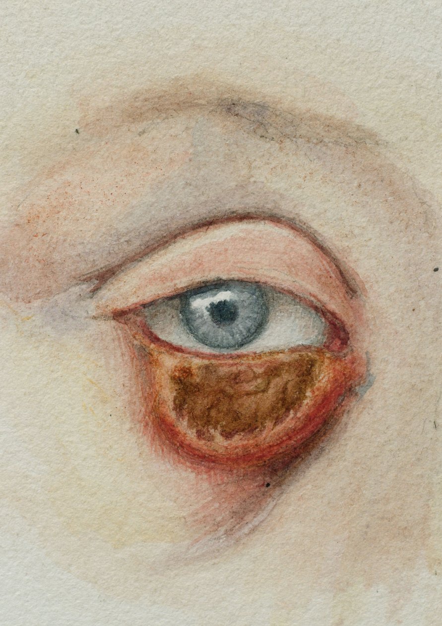 Yeux - Frederick (attr. to) Barnard