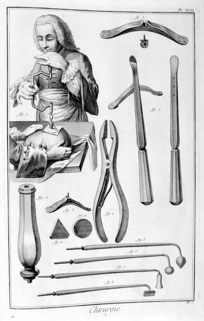 Chirurgie de la tête, 1751-1777 - Unbekannt