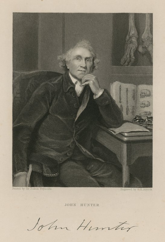 John Hunter - English School