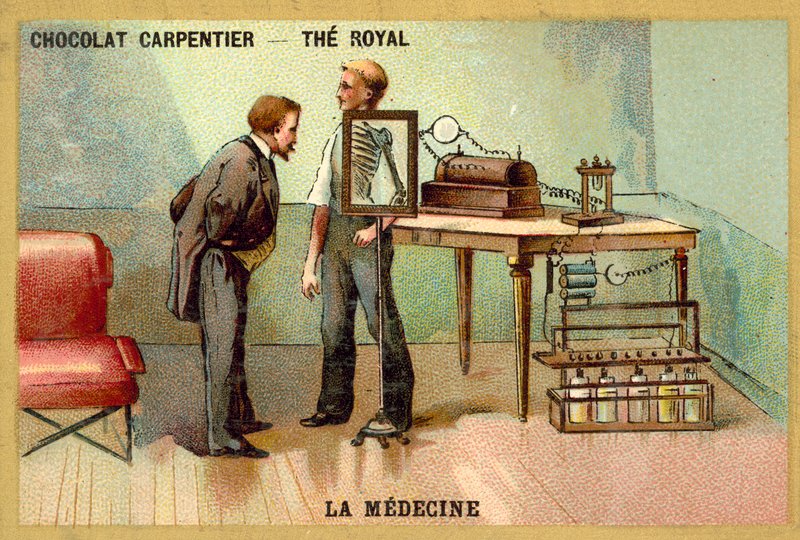 Patient passant une radiographie - French School