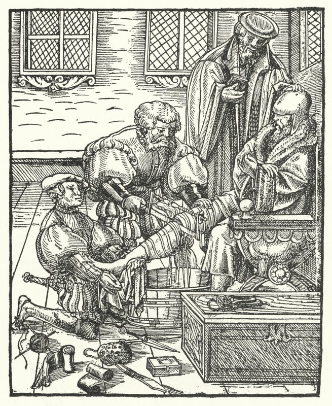 Une Amputation - German School