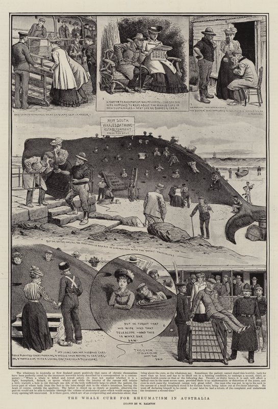 Le remède à la baleine pour le rhumatisme en Australie - William Ralston